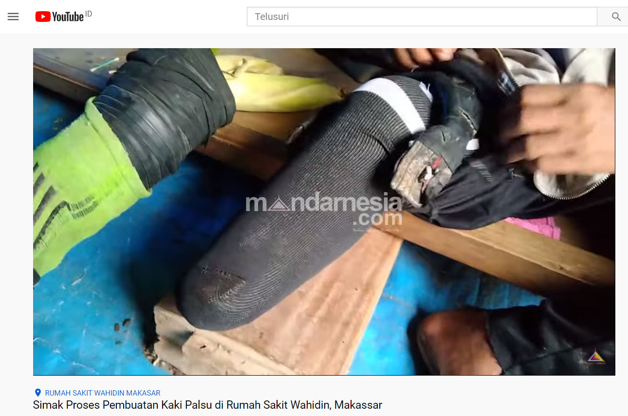 Simak Proses Pembuatan Kaki Palsu di Rumah Sakit Wahidin, Makassar